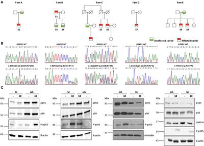 Late-Onset Antibody Deficiency Due to Monoallelic Alterations in NFKB1